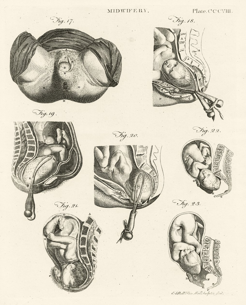 Położna, ilustracja z „Encyklopedii Britannica”, wydanej w Edynburgu, 1798 (miedzioryt) autorstwa Alexander Bell