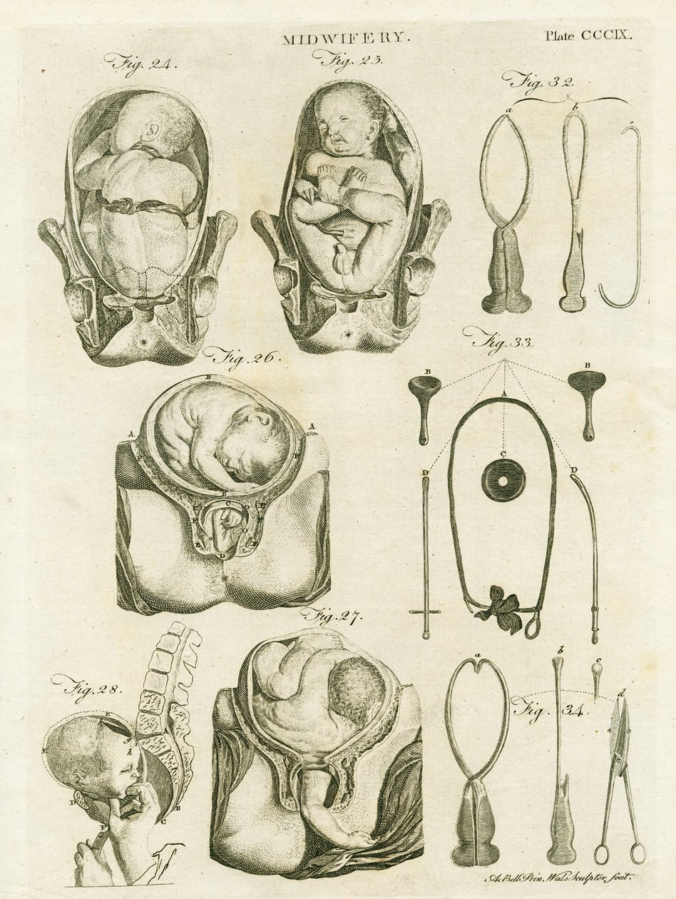 Położnictwo, ilustracja z "Encyklopedii Britannica", wydanej w Edynburgu, 1798 (miedzioryt) autorstwa Alexander Bell