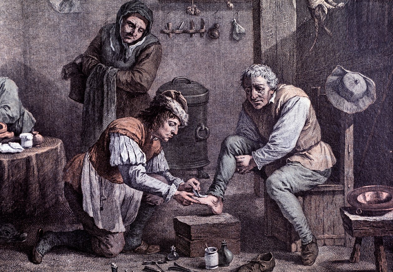 Operacja chirurgiczna (grawerowanie autorstwa Anonymous Anonymous