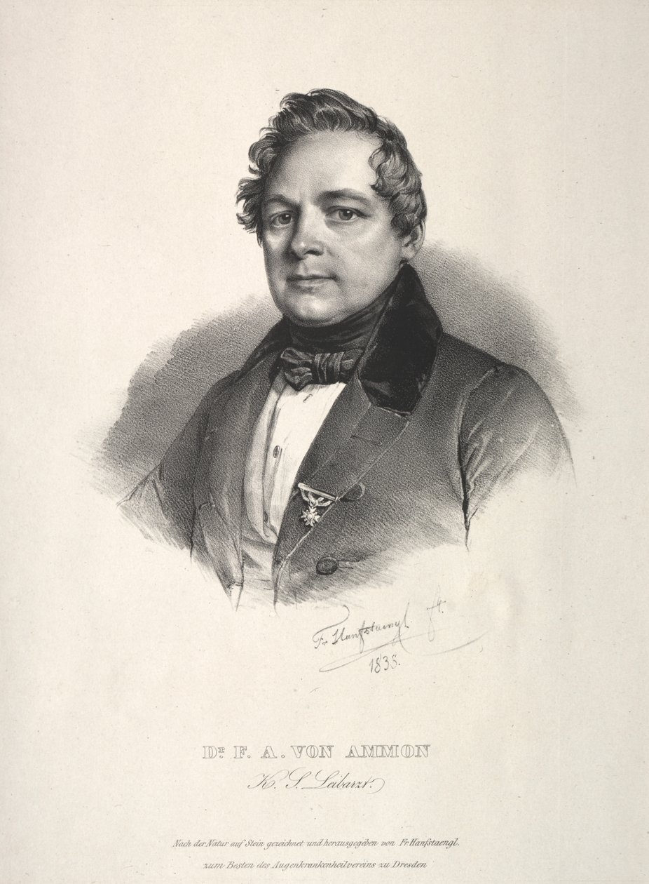 dr Fryderyk August z Ammonu autorstwa Franz Seraph Hanfstaengl
