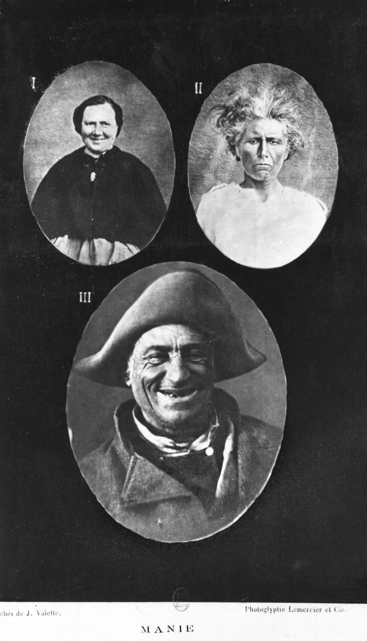 Mania, ilustracja z Nowego podstawowego i praktycznego traktatu o chorobach psychicznych Henri Dagoneta (1823-1902) Paryż, Bailliere, 1876 autorstwa French Photographer