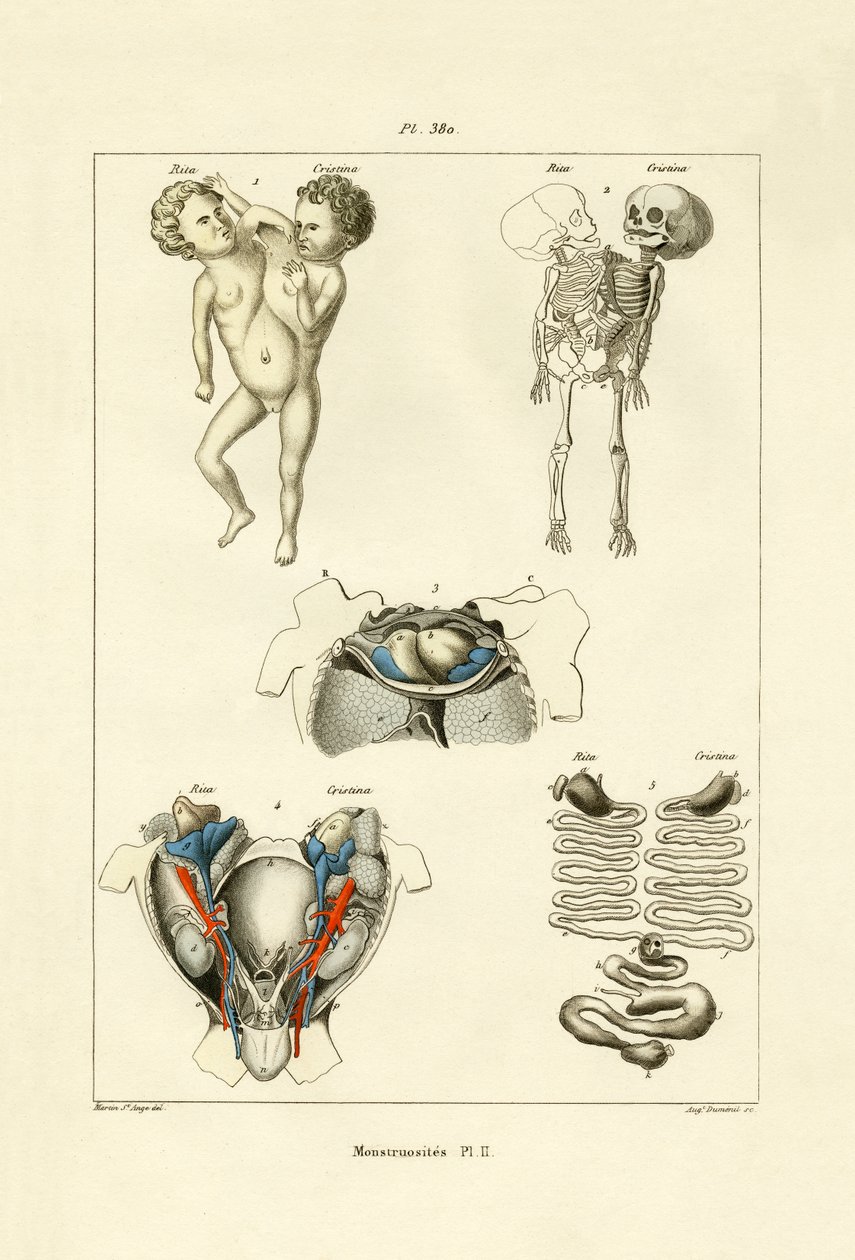 Wybryk, 1833-39 autorstwa French School