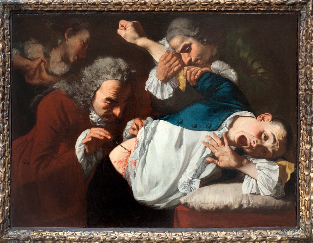 Operacja, 1753-54 autorstwa Gaspare Traversi
