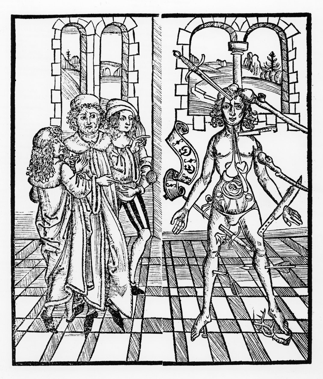 Ranny człowiek z „Das Buch der Cirugia” wydanego w Strasburgu, 1497 r. autorstwa Hieronymus Brunschwig