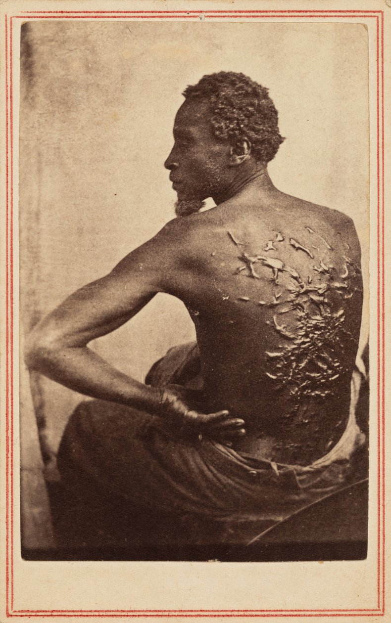 Biczowane plecy, ok. 1863 (zdjęcie) autorstwa McPherson & Oliver