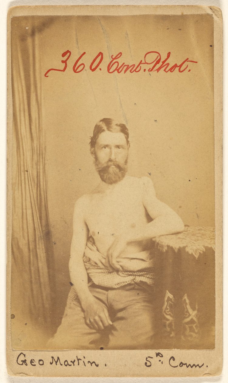 Geo. Martin, 5th Conn. [Ofiara wojny secesyjnej] autorstwa S. Friedlaender