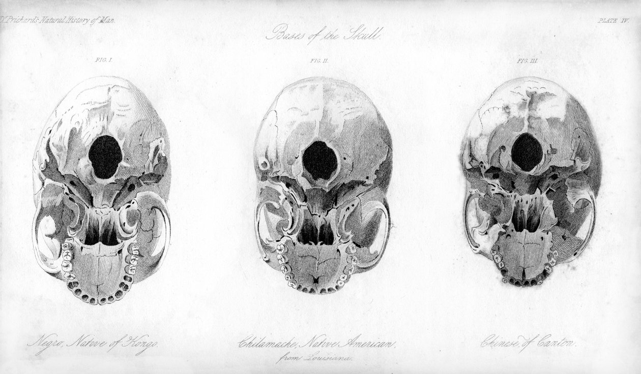 Podstawa czaszki, 1848 autorstwa Unbekannt
