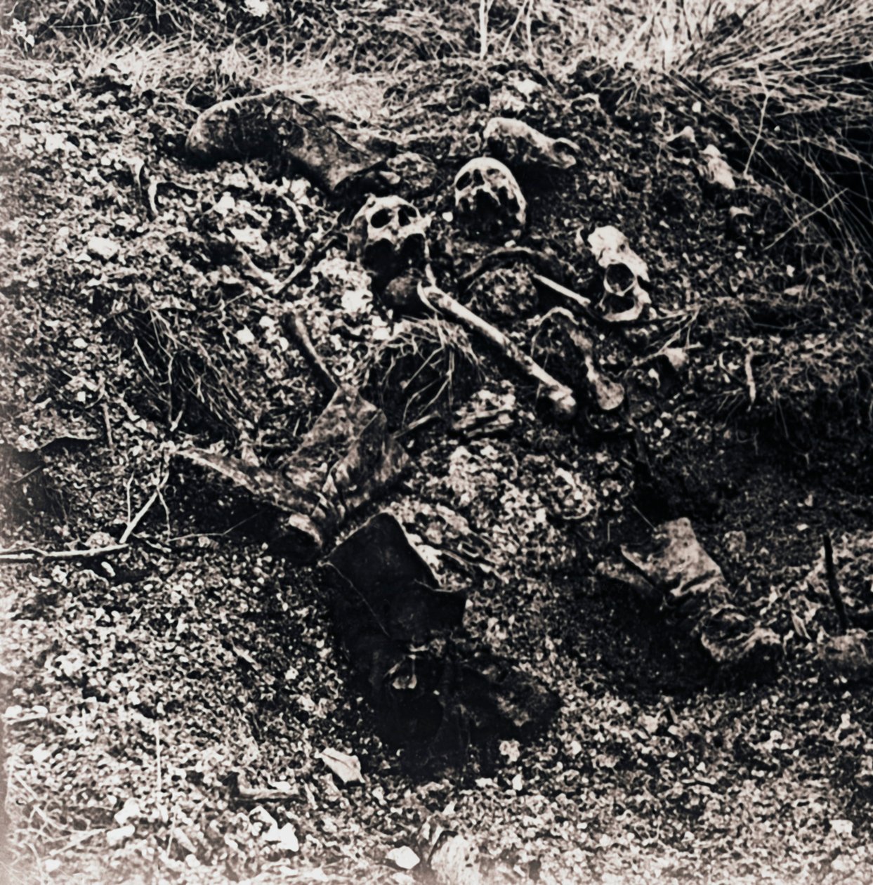 Szczątki ludzkie, c1914-c1918 autorstwa Unbekannt