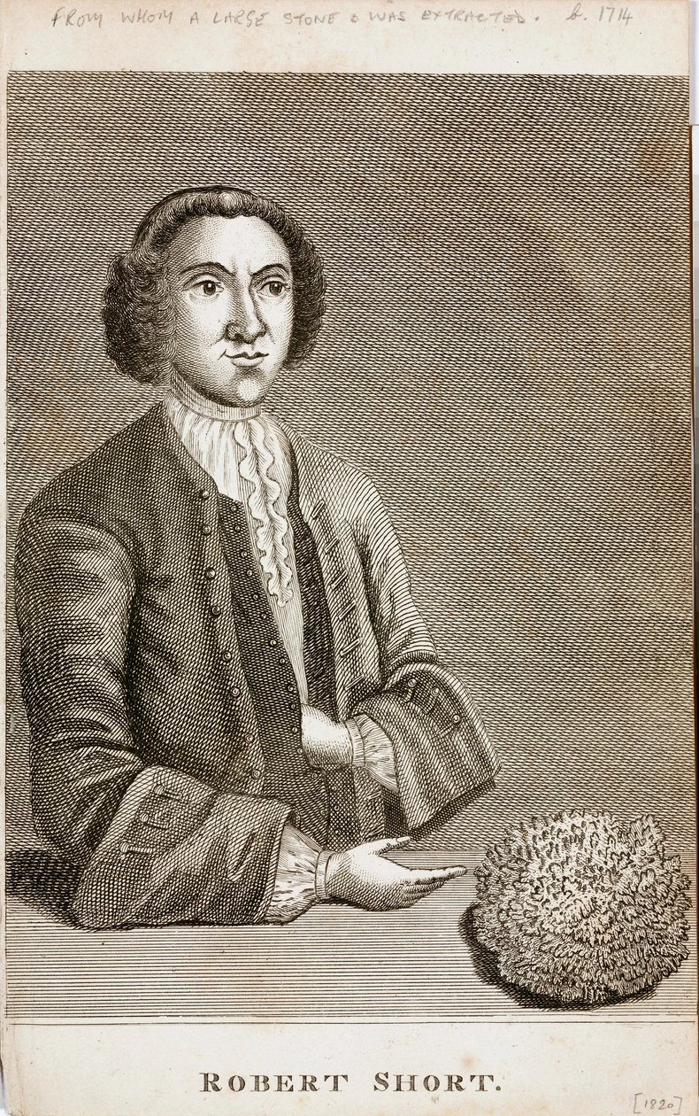 Robert Short, ciekawostka medyczna, ok. 1750 autorstwa Unbekannt