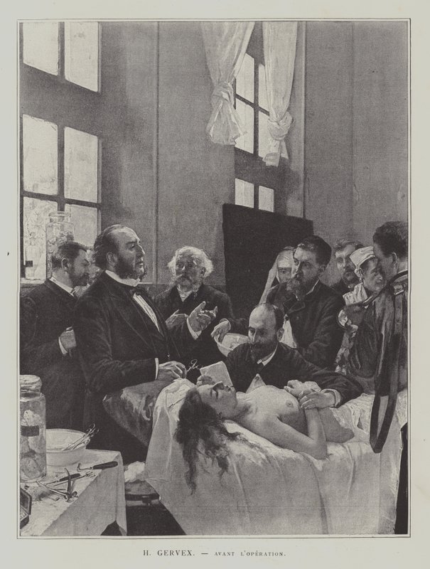 Avant lOperacja (przed operacją) autorstwa Henri Gervex