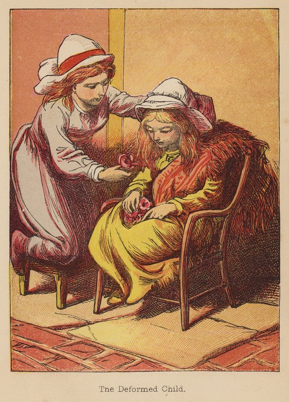 Zdeformowane dziecko (kolorowa rycina) autorstwa Thomas Dalziel